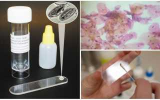 Соскоб на энтеробиоз: алгоритм взятия и результаты