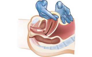 Как правильно проводится массаж матки?