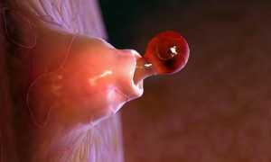 Можно ли забеременеть во время месячных