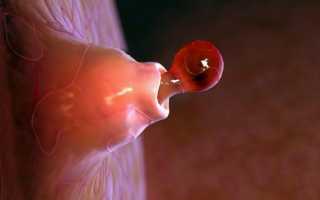 Можно ли забеременеть во время месячных