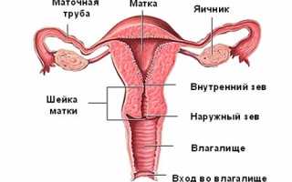 Короткая шейка матки при беременности