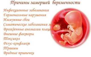 Почему возникает замершая беременность?