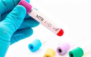 Онкомаркеры для женщин: норма и расшифровка анализа