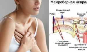 Боль в грудине посередине у женщины или мужчины — причины и признаки