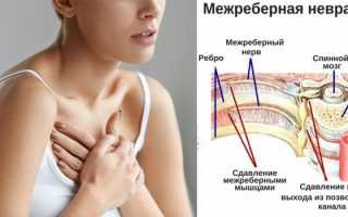 Боль в грудине посередине у женщины или мужчины — причины и признаки