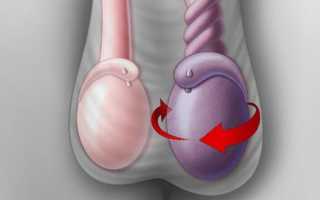 Опухло яичко у мужчины (правое, левое): причины, что делать?
