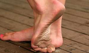 Подошвенные бородавки — причины возникновения, симптомы и лечение