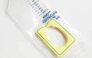 Сколько хранится моча для анализа грудничка