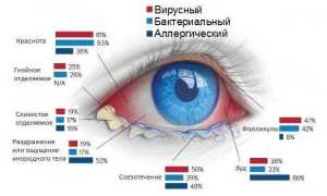Аденовирусный конъюнктивит у взрослых — причины, симптомы, диагностика и леченине