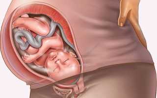 Что делать если роды начались на 36-й неделе, советы врачей