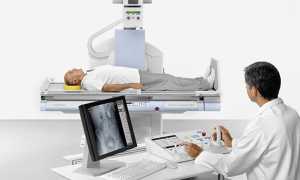 Диагностика остеопороза — методы выявления признаков заболевания