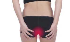 Эффективные методы лечения и профилактики анального кандидоза