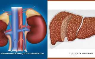 Мочегонные таблетки при отеках ног — обзор препаратов с названиями