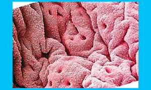 Тонкий эндометрий: причины, симптомы, лечение и зачатие