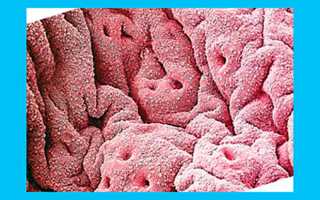 Тонкий эндометрий: причины, симптомы, лечение и зачатие