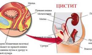 Канефрон: инструкция по применению, цены, отзывы