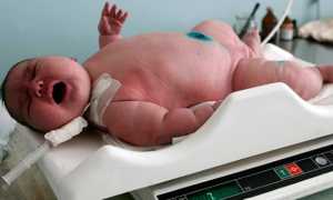 Причины ожирения у детей — экзогенные и эндогенные факторы