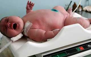 Причины ожирения у детей — экзогенные и эндогенные факторы