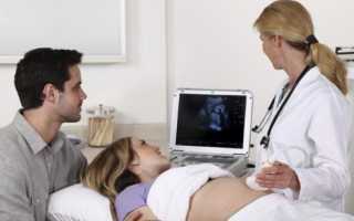 Второй скрининг при беременности и что туда входит?