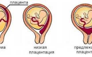 Насколько совместимы секс и тонус матки: полезные советы, удобные позы