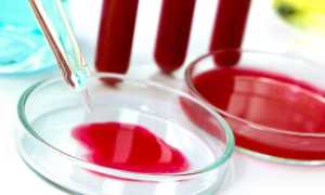 Норма тромбоцитов в крови у женщин, мужчин и детей — причины повышенных или пониженных показателей