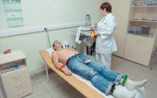 ВСД и экстрасистолия: причины, симптомы, диагностика, лечение