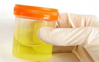 Эритроциты в моче у ребенка — показания к проведению анализа, причины отклонений от нормы и методы лечения