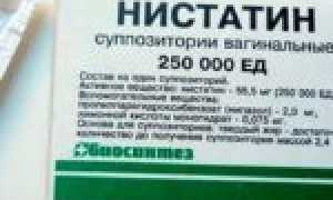 Способы лечения заболевания молочница (кандидоз)