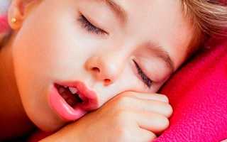 Признаки аденоидов у детей и взрослых — проявления и методы лечения