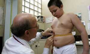 Лишний вес и паразиты: есть ли взаимосвязь?