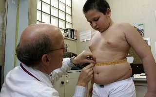 Лишний вес и паразиты: есть ли взаимосвязь?