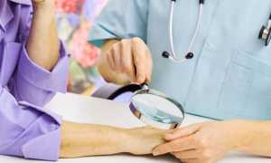 Точки на ногтях — причины появления, какие болезни вызывают симптом, методы лечения и профилактики