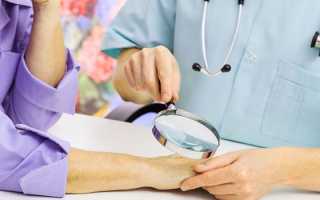 Точки на ногтях — причины появления, какие болезни вызывают симптом, методы лечения и профилактики