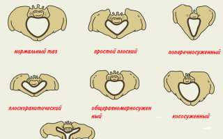 Роды без разрывов, возможно или нет?