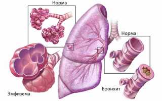 Химотрипсин – инструкция по применению