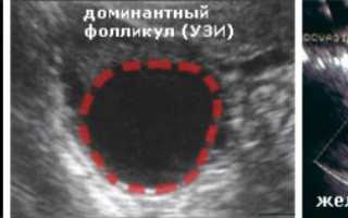 Как узнать, в каком яичнике происходит овуляция?