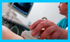 Старое желтое тело с прошлого цикла: почему и что делать