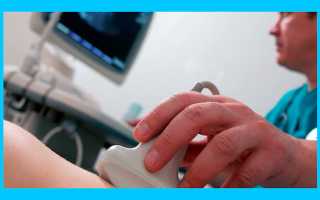 Старое желтое тело с прошлого цикла: почему и что делать