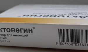Очаговая алопеция у мужчин – лечение препаратами, народными средствами