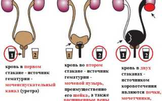 Почему в конце мочеиспускания появляется кровь