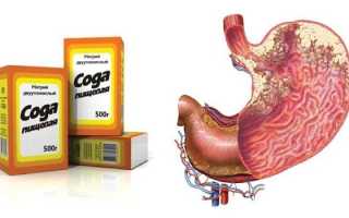 Лечение полипов в кишечнике народными средствами — лучшие рецепты