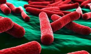 Абсцесс почки — симптомы и признаки заболевания, диагностика, способы лечения, осложнения