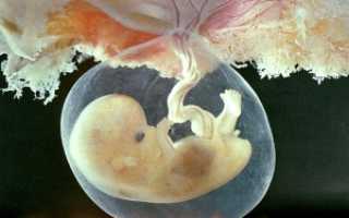 Ретрохориальная гематома при беременности. Стоит ли паниковать?