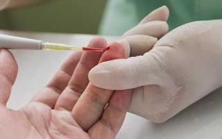 Профилактика вирусного гепатита В — общие, специфические и экстренные меры