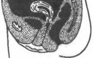 Всё, что нужно знать об антепозиции матки