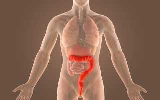 Геморроидальное кровотечение – симптомы и признаки осложнений