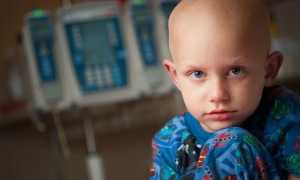 Опухоль костного мозга — причины возникновения, симптомы, диагностика, методы лечения и прогнозы