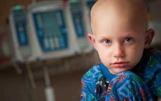 Опухоль костного мозга — причины возникновения, симптомы, диагностика, методы лечения и прогнозы