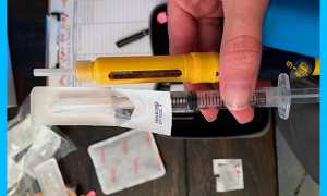 Повышенный эстрадиол у женщин: причины, симптомы, лечение