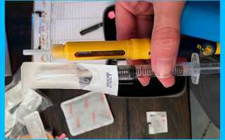 Повышенный эстрадиол у женщин: причины, симптомы, лечение